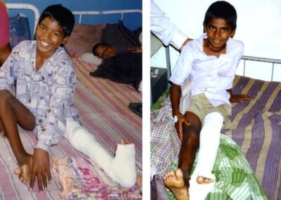 C• Boys Post-Surgery