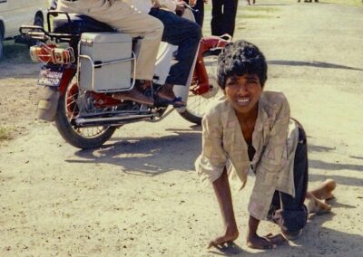 D•Pareek Crawling for Surgery